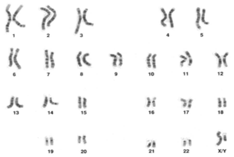 染色体と遺伝を解説